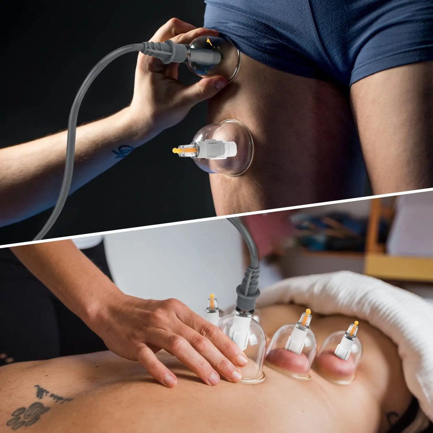 Hijama